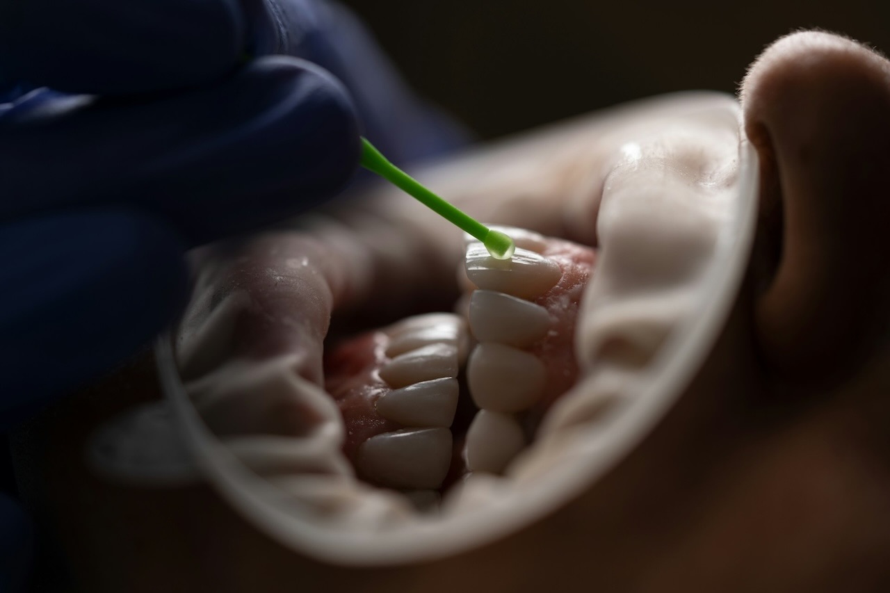 A dental professional applying a substance to a patient's tooth using a dental applicator.