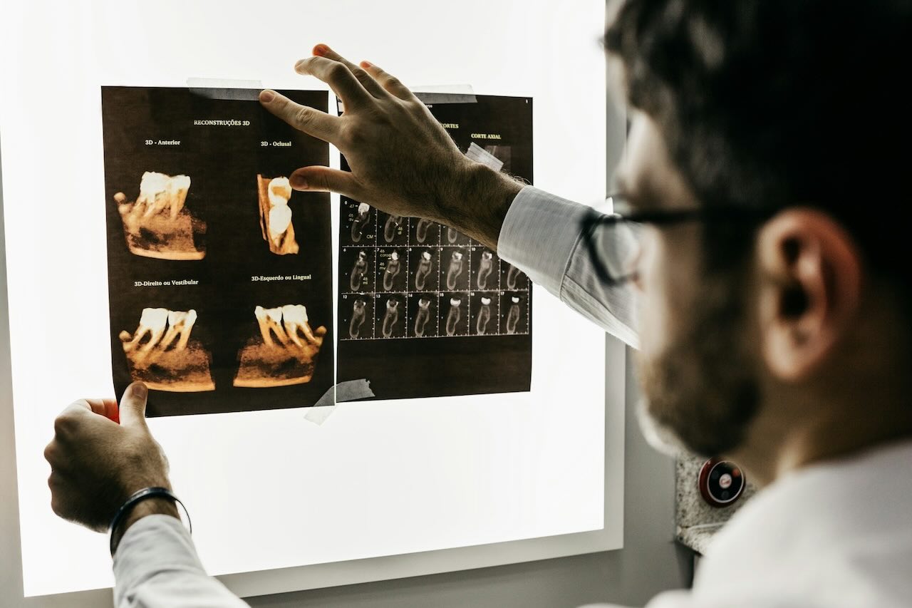 A dentist examining dental X-rays on a lightbox.