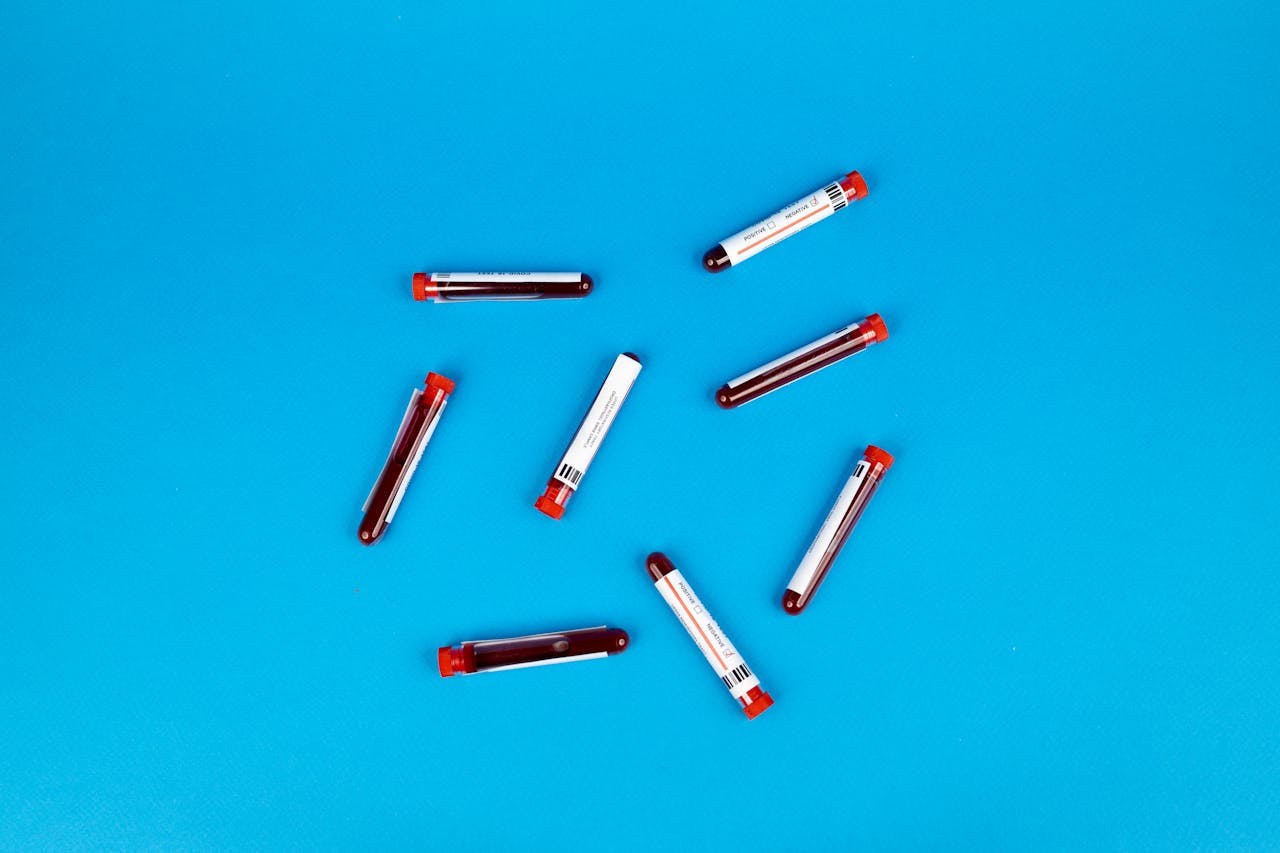 Blood sample vials arranged on a blue background, representing tools used in careers in haematology.