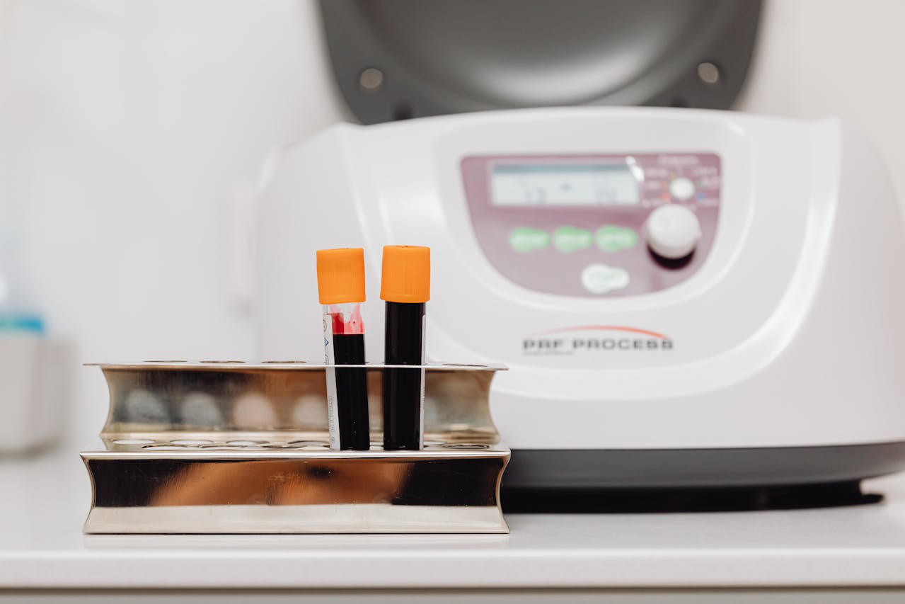 Two blood-filled test tubes with orange caps are placed in a metal rack beside a laboratory centrifuge marked "PRF Process."