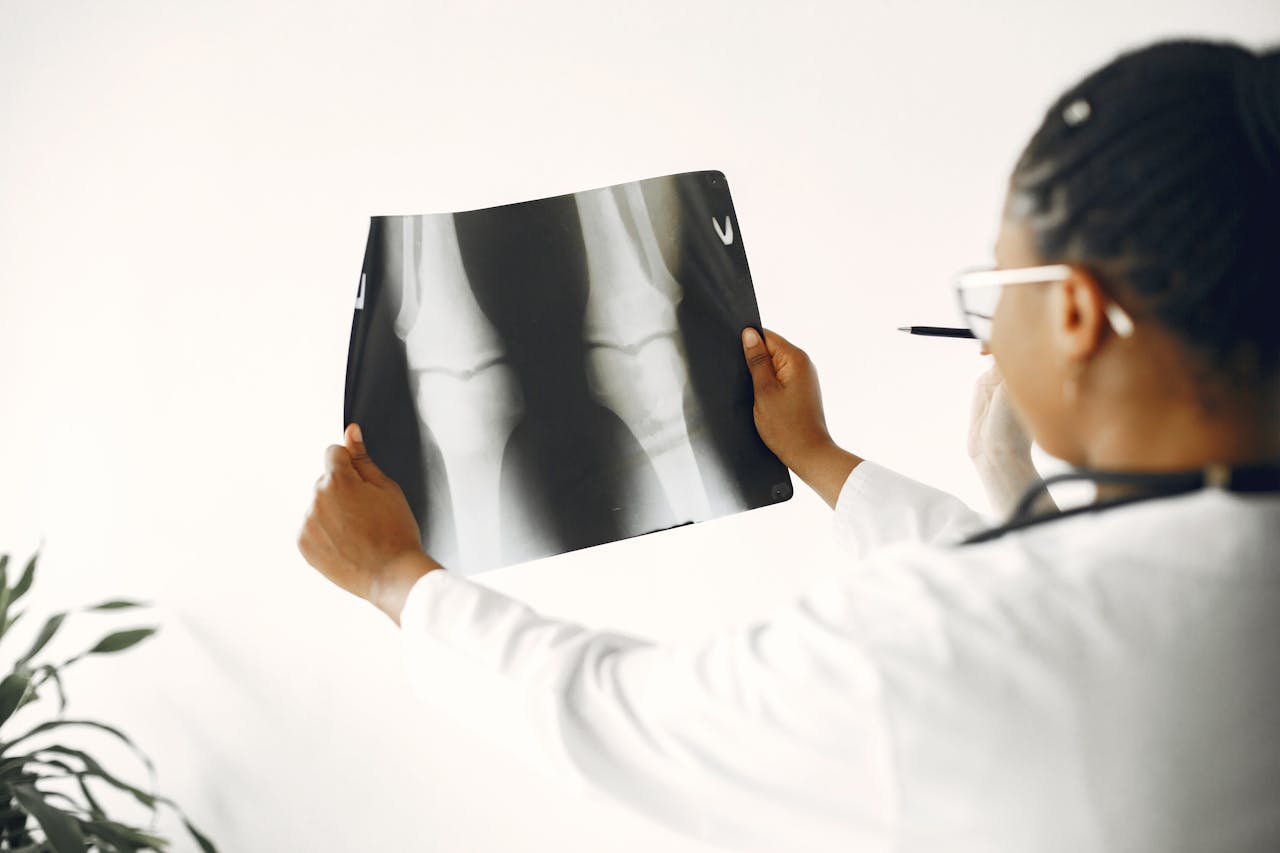 Orthopaedic surgeon reviewing a knee X-ray for signs of joint damage or injury.