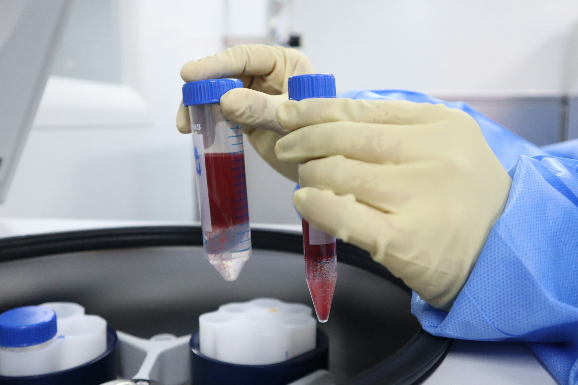 A lab technician holding two centrifuge tubes containing blood samples during a haematology test procedure.