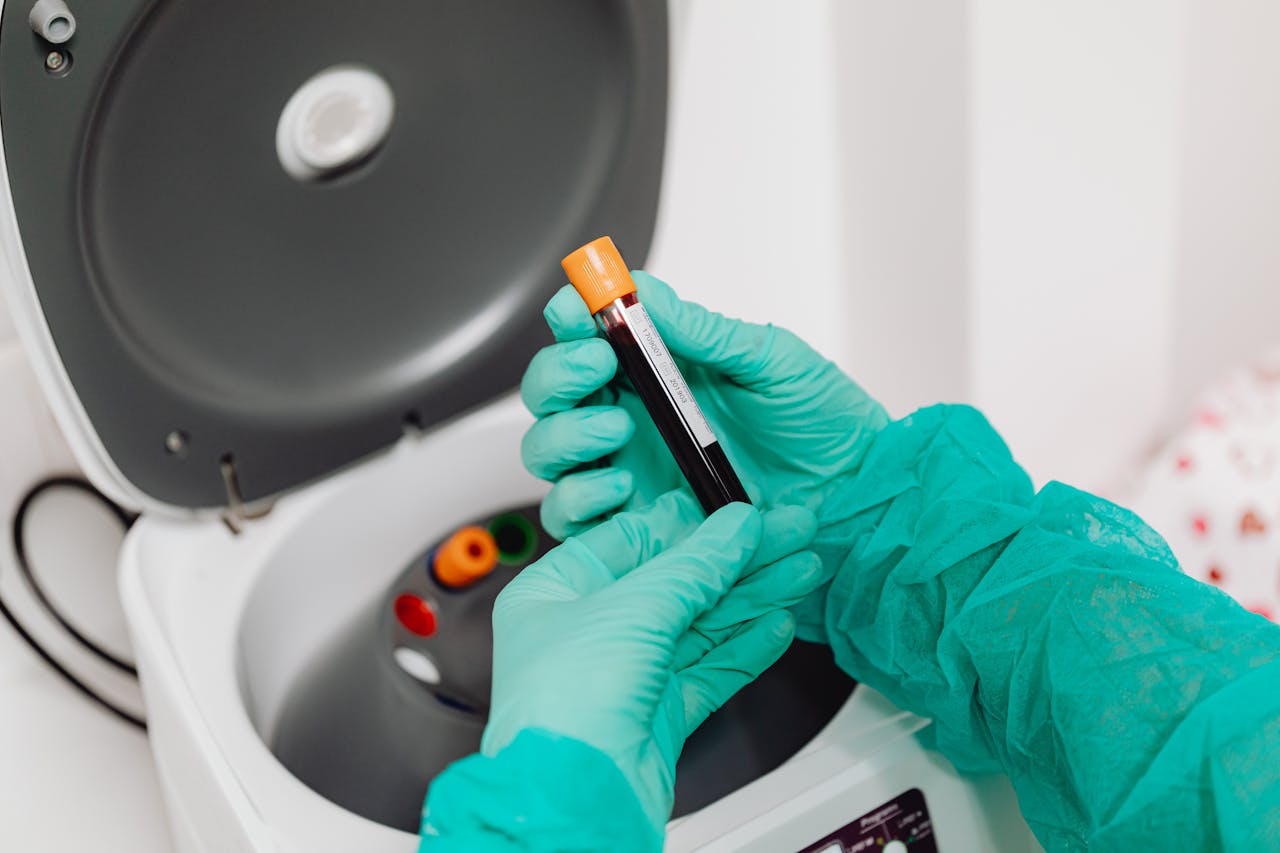 Gloved hands holding a blood sample vial near a centrifuge machine in a medical laboratory.
