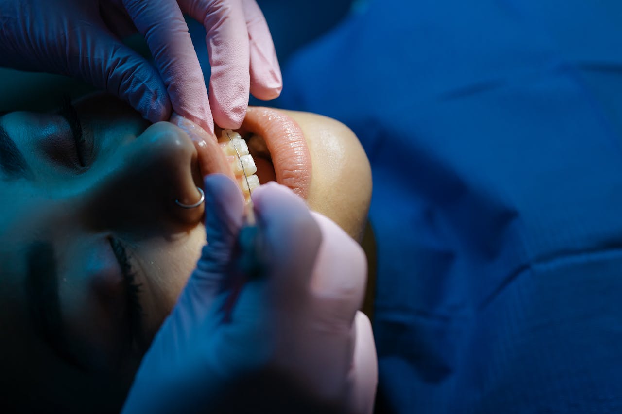 Dentist carefully adjusting clear dental braces on a patient's upper teeth during an orthodontic procedure in a clinical setting.