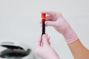 Gloved healthcare worker holding a blood sample for haematology analysis.