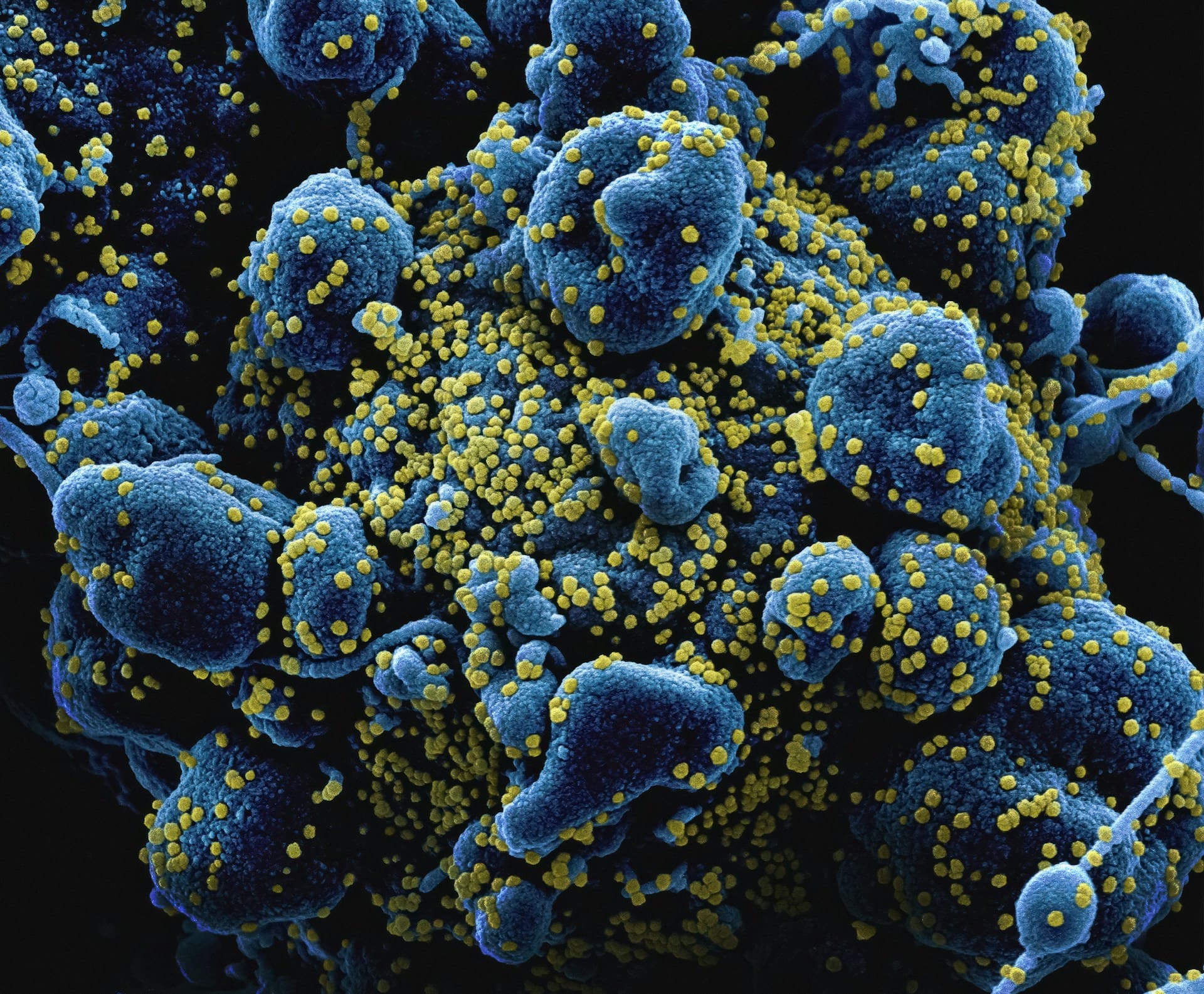 A high-resolution microscopic image of cells heavily infected by virus particles, representing the study of virology within microbiology.