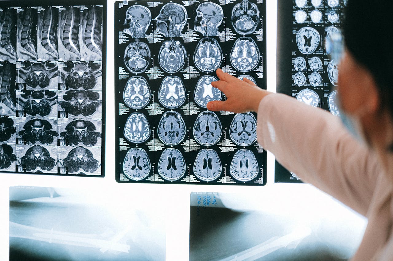 Pathologist analysing brain scan images to diagnose neurological conditions.
